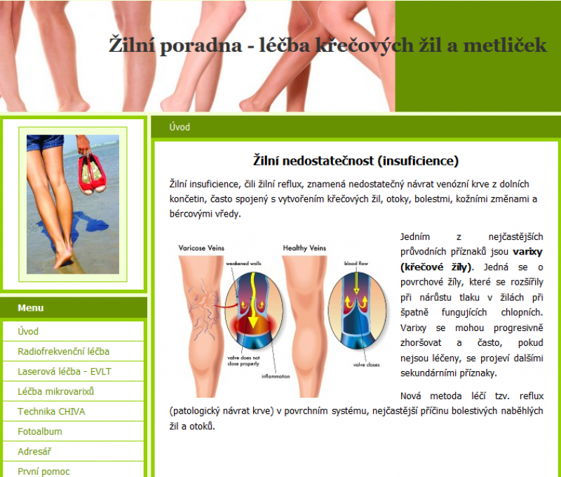 Nový web zaměřený na léčbu křečových žil