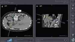 imactis-obrazovka imactis-obrazovka